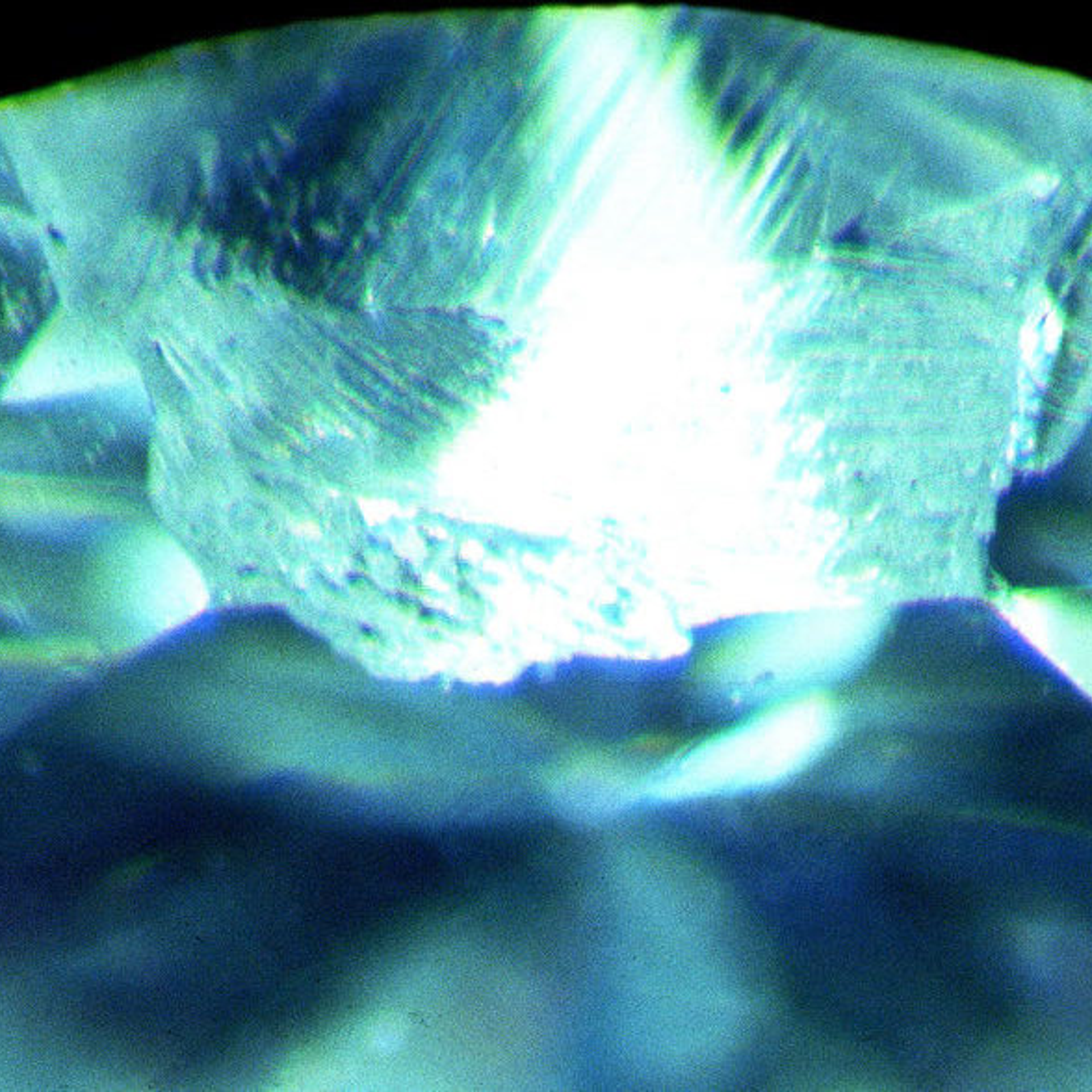 Ruby Fracture Fracture